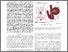 [thumbnail of 3D_Printed_Variable_Length_Magnetically_Steered_Catheter_Tip_for_Enhanced_Access_in_Aneurysm_Interventions.pdf]