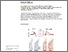 [thumbnail of Lack of Oncomodulin Increases ATP-Dependent Calcium Signaling and Susceptibility to Noise in Adult Mice.pdf]